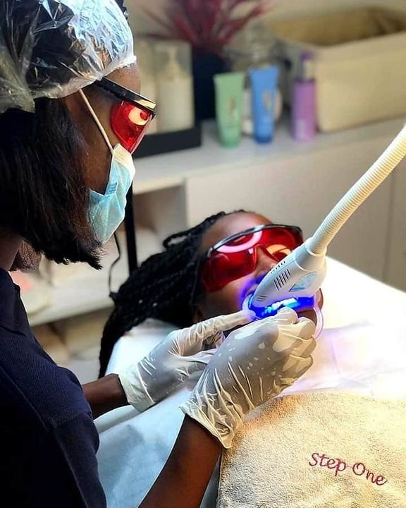 Blanchiment dentaire